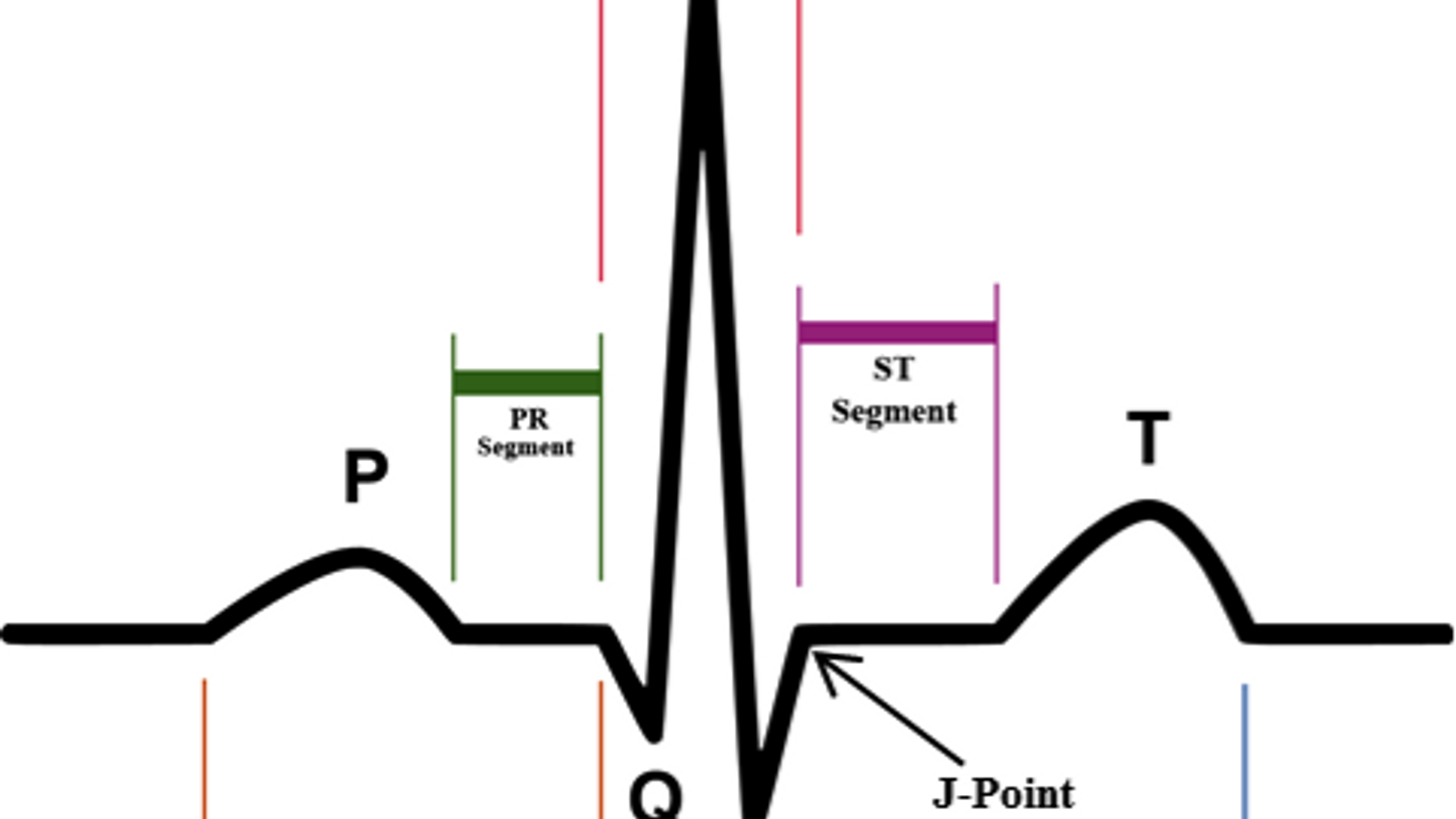 Apprentissage de A à Z de l'ECG.